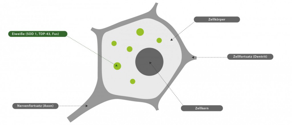 ALS_Pathogenese & Genetik_Proteinopathie_Stufe 1